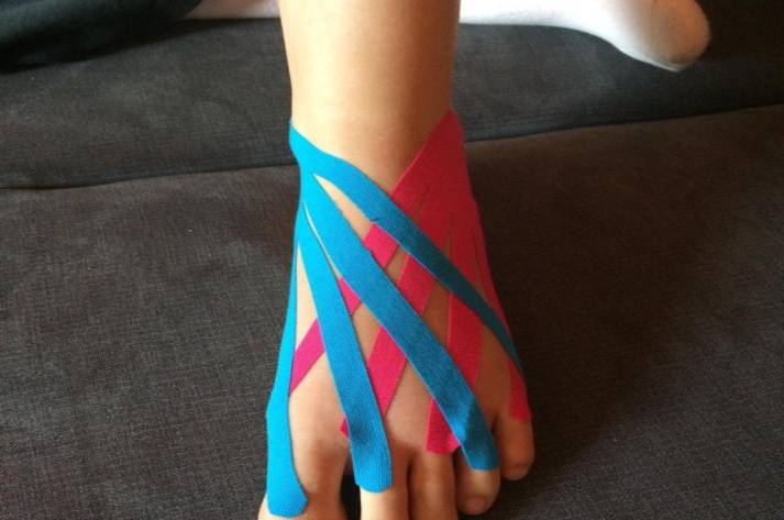 kinesiotaping