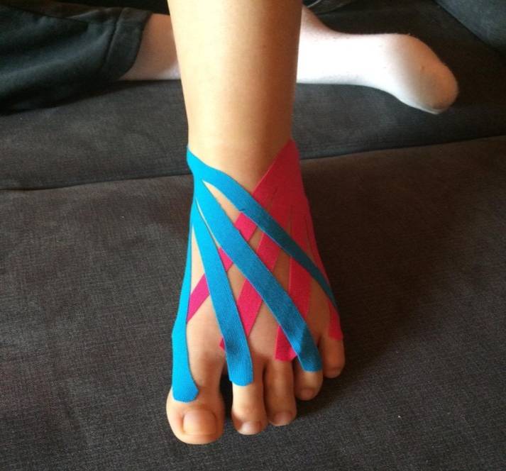 kinesiotaping